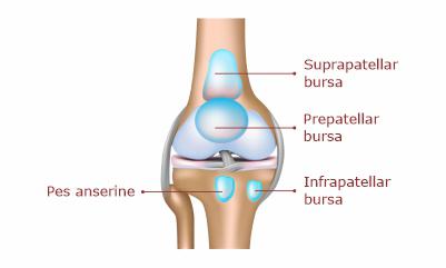 Types-of-bursitis-causisng-pain-in-knee-or-around-knee